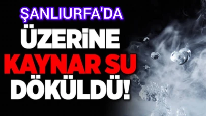 Şanlıurfa’da Korkunç Kaza: Kaynar Su Üzerine Dökülen 1 Yaşındaki Çocuk Yaralandı